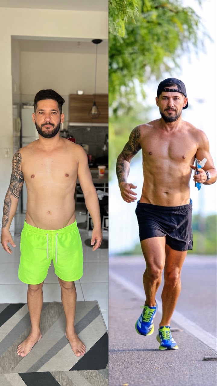 Antes e depois — paciente em processo de emagrecimento e performance