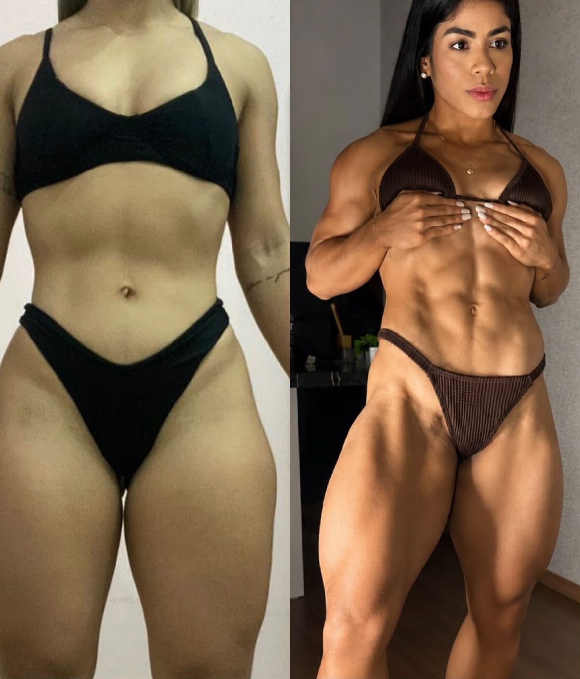 Antes e depois — paciente com foco em definição muscular