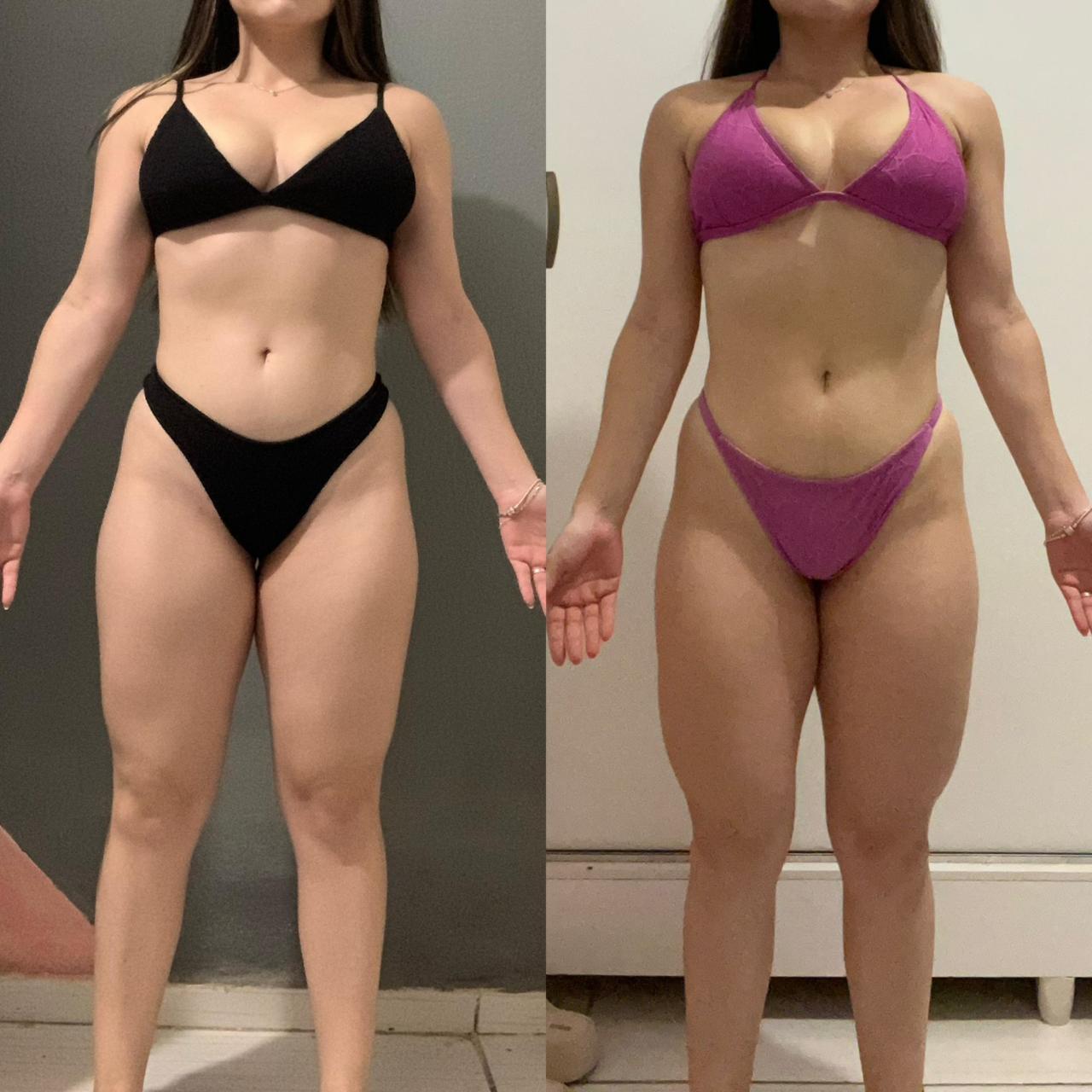 Antes e depois — paciente em recomposição corporal